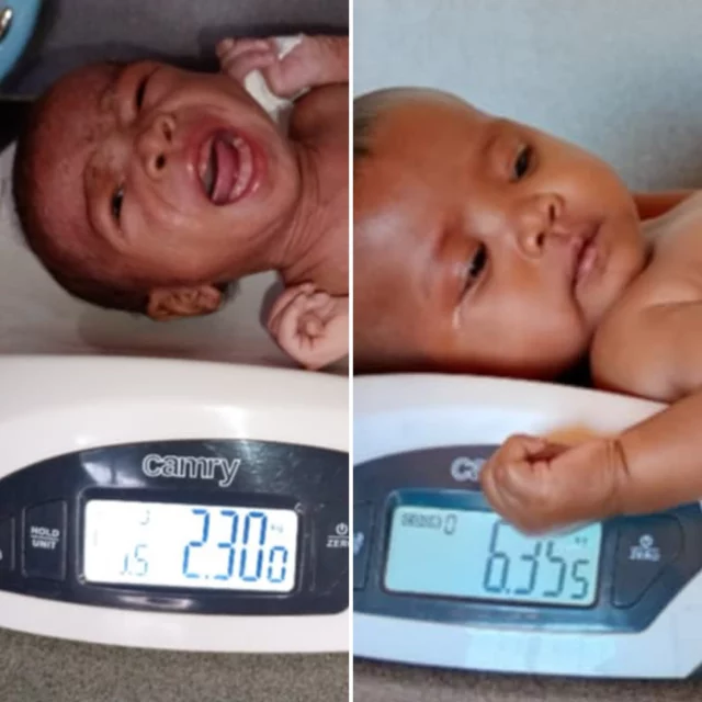 Wendy! From 2.300 to 6.350 kg! 🧡 Mission completed! Our brave little warrior has made an incredible journey — from severe malnutrition to strength and health. With consistent medical care, nutritional support, and the dedication of our entire team, Wendy can now enjoy childhood as it should be: without pain, with a smile, and a full belly.

This is not just one child’s story — it’s proof that help truly makes a difference and saves lives. Thank you to everyone supporting our work in Madagascar.

#Wendy #FoundationForMadagascar #FromHungerToHope #MalnutritionRecovery #HumanitarianWork