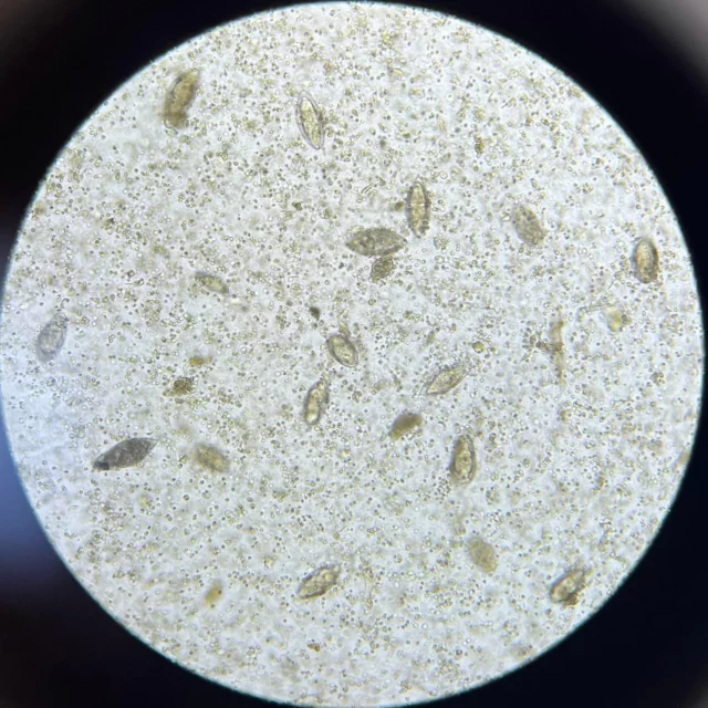 Don’t judge people — you never know what kind of rich inner life they carry. #SchistosomaHaematobium #Schistosomiasis #NTDs #TropicalMedicine #PublicHealth #Madagascar #GlobalHealth #Parasites #Microscopy #MedicalParasitology #Africa #HiddenDiseases #NeglectedTropicalDiseases #TropikiPodMikroskopem #ZdrowieGlobalne #Pasożyty #MedycynaTropikalna