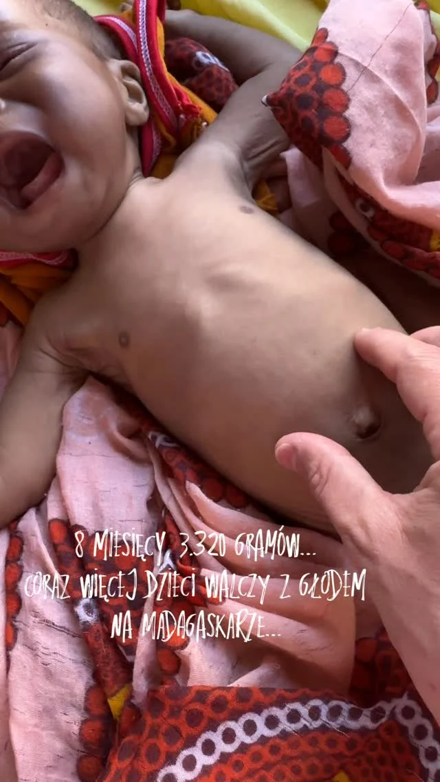 Nazywam się Daniel i od 10 lat wspieram leczenie niedożywionych dzieci na Madagaskarze. Prowadzę szpital w małej wiejskiej miejscowości, robiąc wszystko co w mojej mocy, by ratować maluchy umierające z głodu…